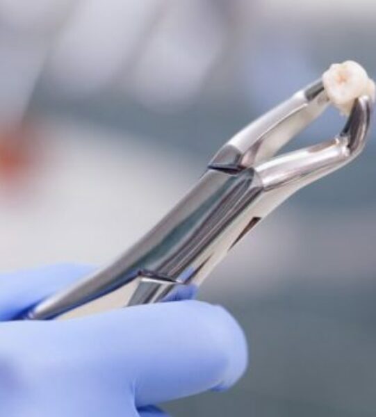 tooth-extraction-925x425-768x353