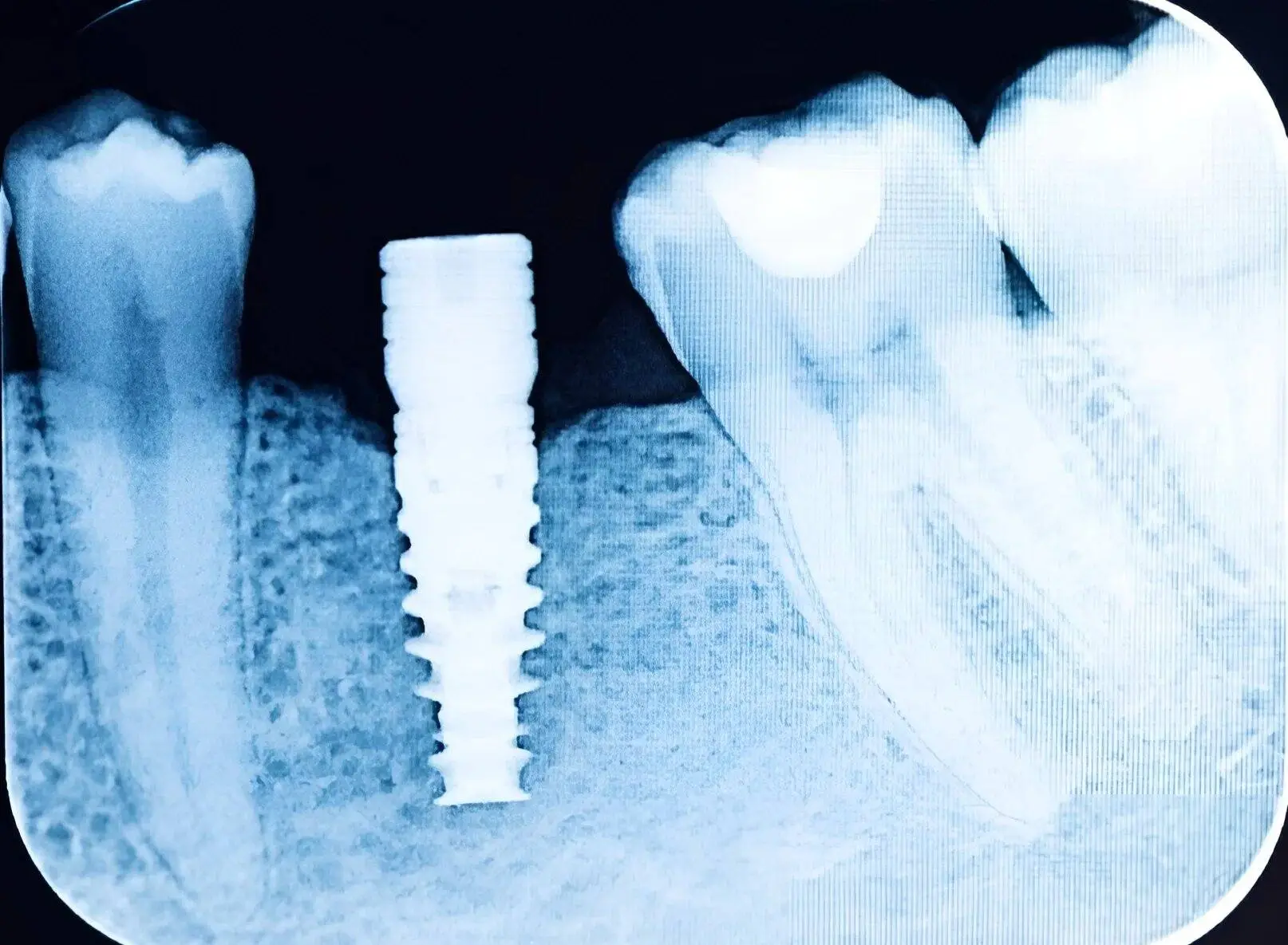 shutterstock 597942311 min 1024x792.jpg 1