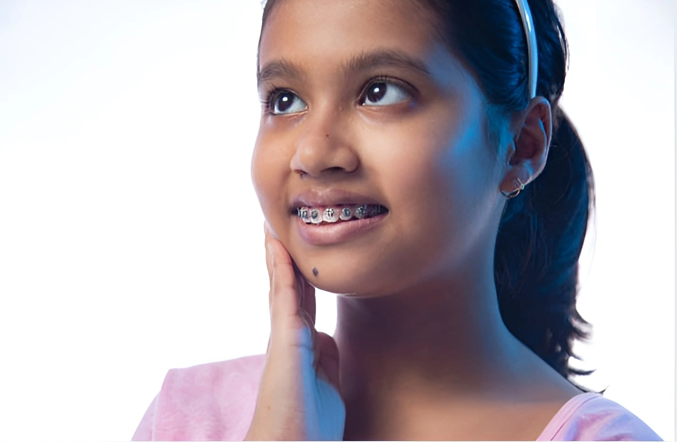 teeth braces in islamabad